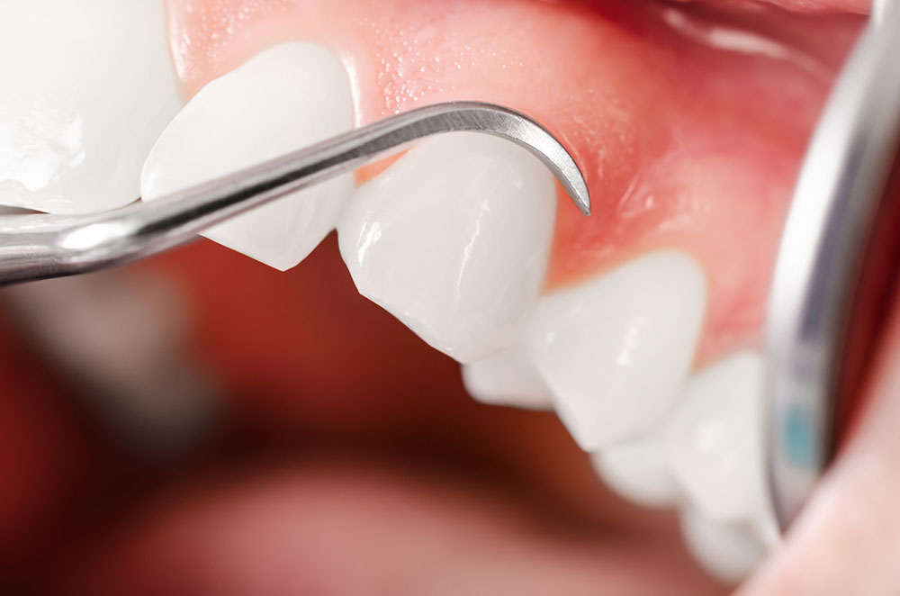 Soins dentaires Fréjus - Centre Médico-Dentaire Fréjus - Dentiste Fréjus